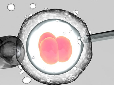 用短期试管婴儿方案不可能移植新鲜胚胎吗？
