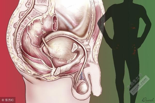 什么是前列腺钙化？医生是这样解释的